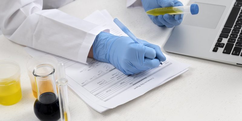 lab-doctor-performing-medical-exam-urine (1)-min